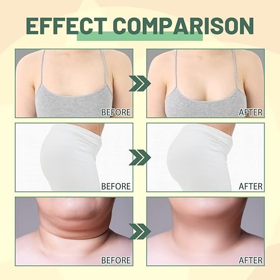 Collagen Lifting Body Oil, Beauty Women Tight Skin Trendy Zone